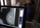 Resolução amplia acesso e retira limite etário para realização do exame