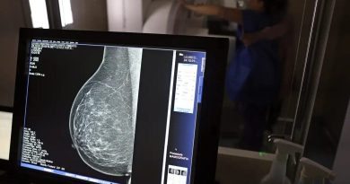 Resolução amplia acesso e retira limite etário para realização do exame