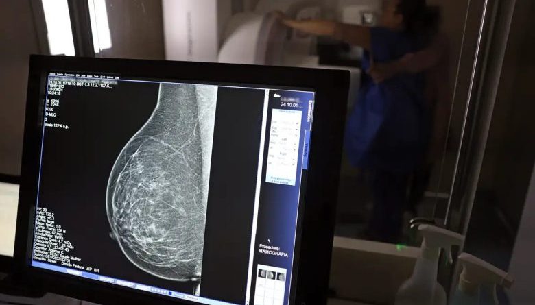 Resolução amplia acesso e retira limite etário para realização do exame