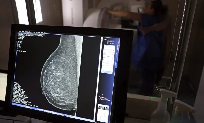 Resolução amplia acesso e retira limite etário para realização do exame